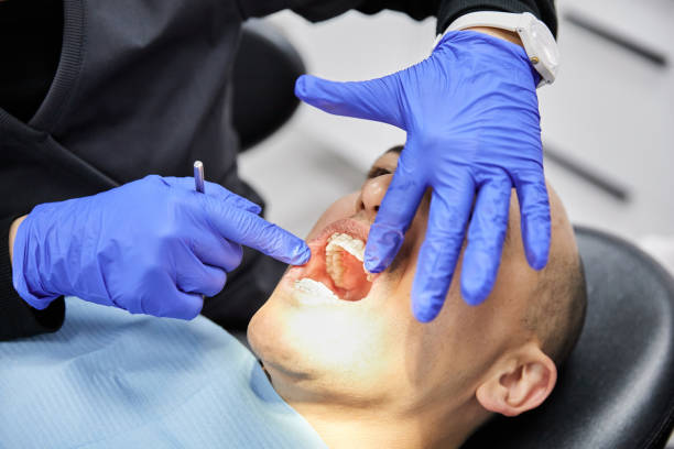 Best Emergency Treatment for Oral Infections in Alamosa East, CO